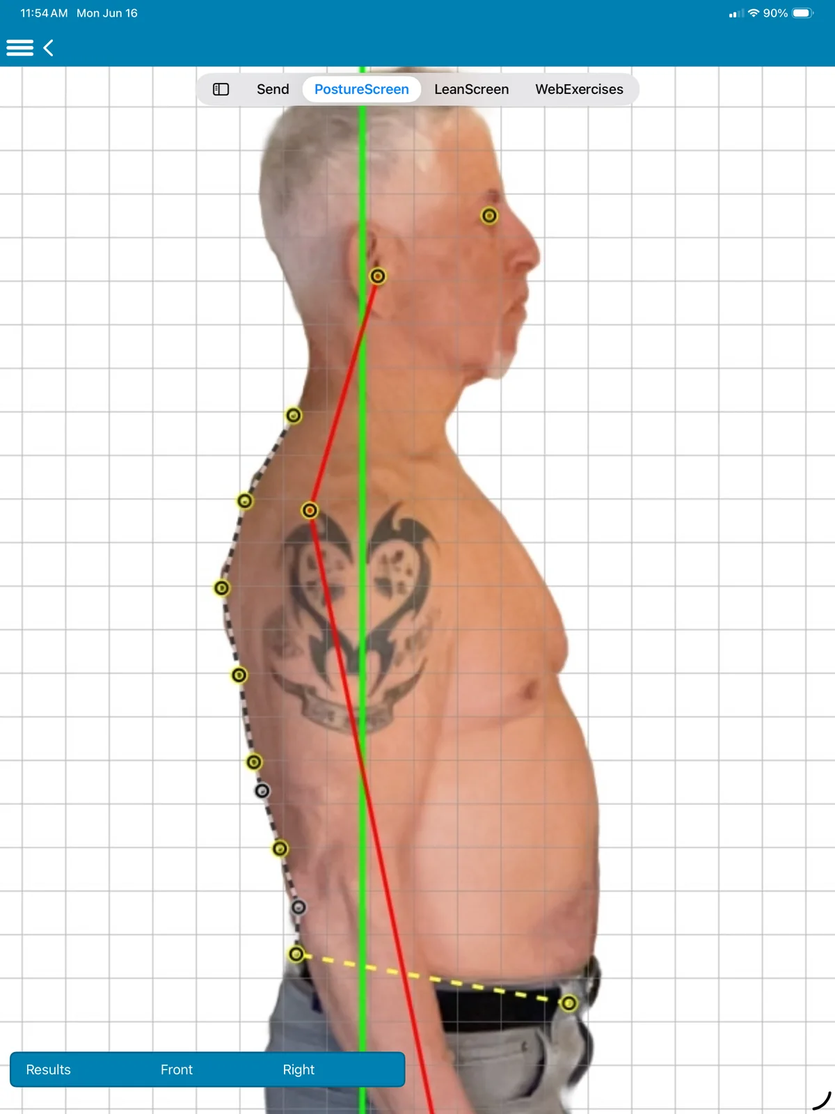 PostureScreen lateral view on iPad: landmark dots from ear to ankle with a posture line and plumb line on a grid.