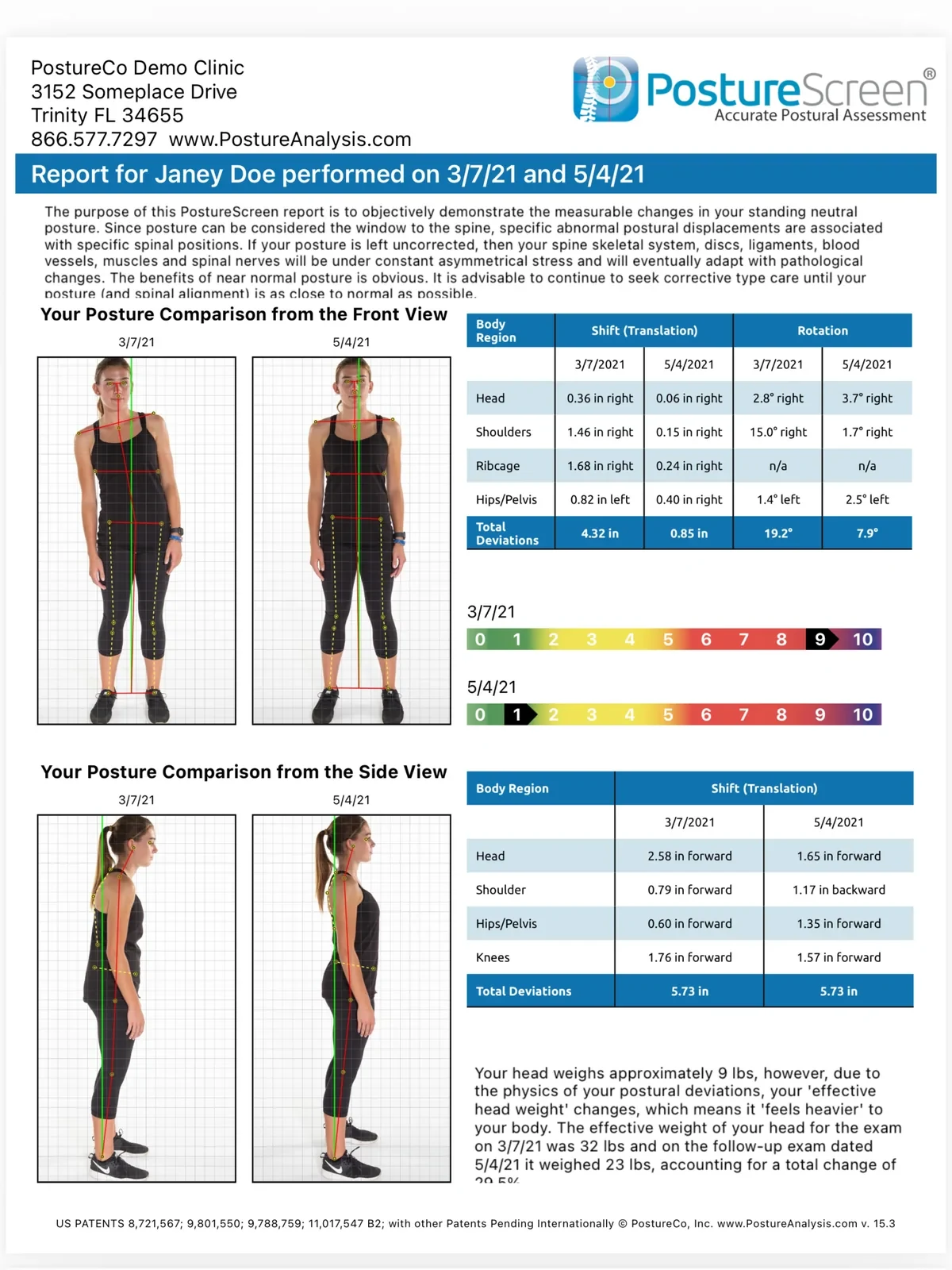 PostureScreen comparison report for the demo client Janey Doe: front and side views from two visits with colored deviation scales.
