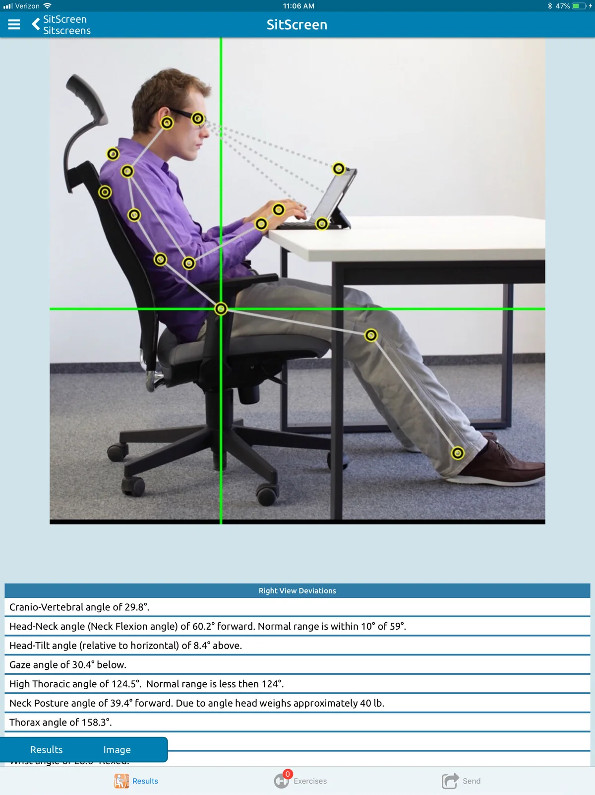 SitScreen on iPad: a man at a laptop in side view with landmark dots and angle lines, above seated posture angles.