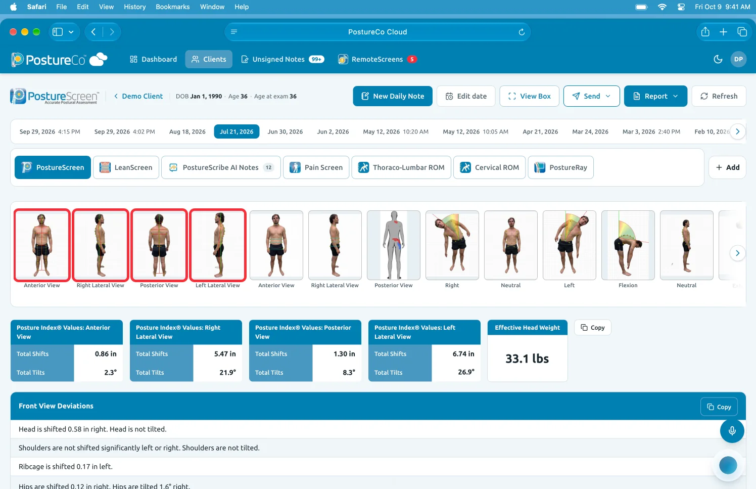 PostureCo Cloud preview, coming soon, in a web browser: a demo client's exams on one timeline by date, with PostureScreen, LeanScreen, PostureScribe AI Notes, Pain Screen and range-of-motion tabs, four posture views and Posture Index values.