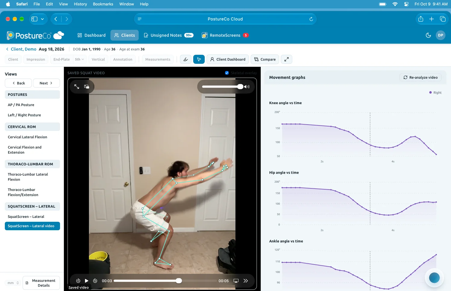 PostureCo Cloud preview, coming soon: a SquatScreen lateral video with a skeletal overlay beside graphs of knee, hip and ankle angles over time.
