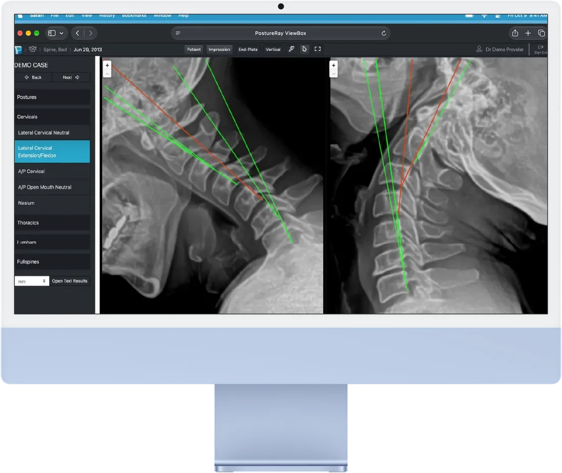 The PostureRay Virtual ViewBox in Safari on an iMac, showing lateral cervical X-rays with green and red lines of mensuration.
