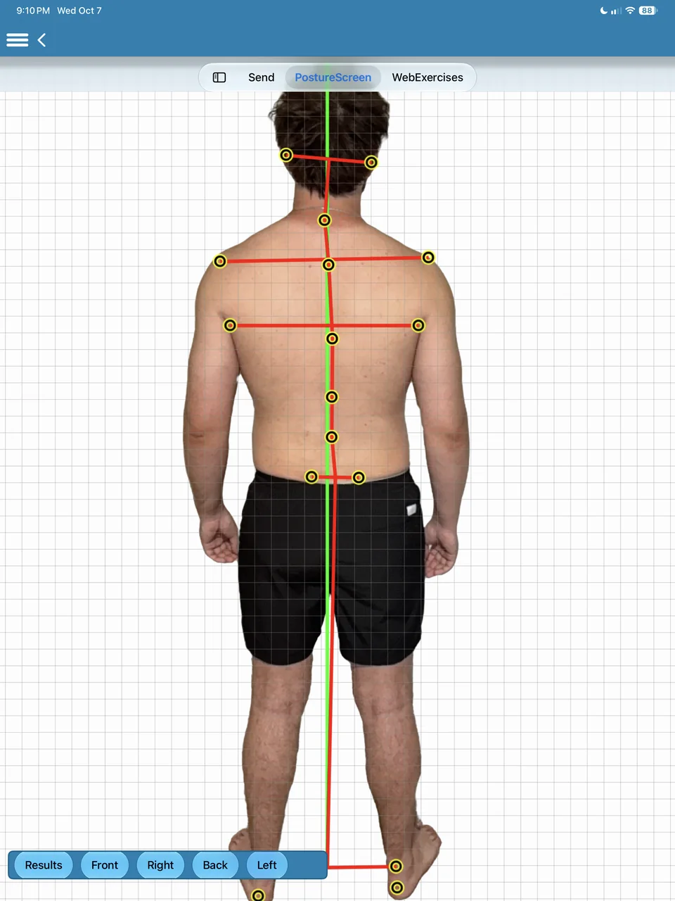 Back view: shoulder and hip level lines and a spinal line.