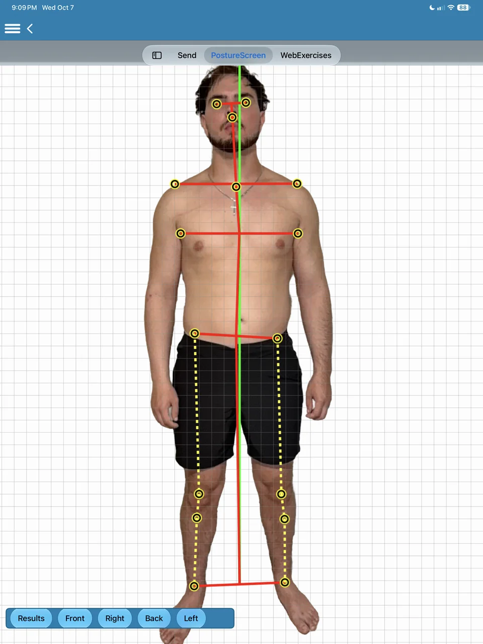 Front view on iPad: landmarks at the head, shoulders, hips, knees and ankles with level lines and a plumb line.