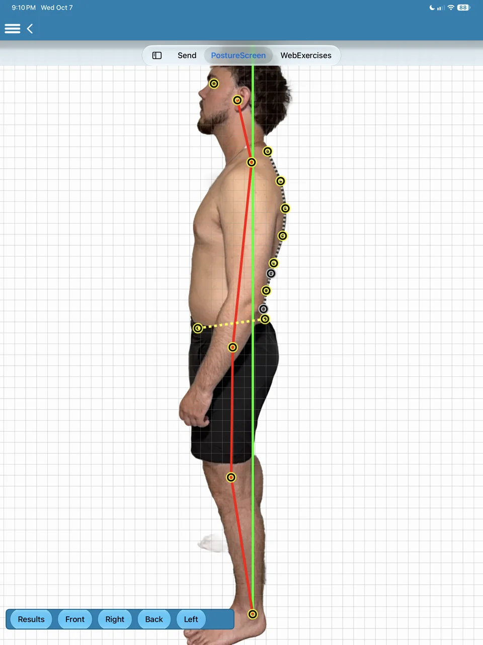 Left side view: landmarks along the spine with the posture line and the plumb line.