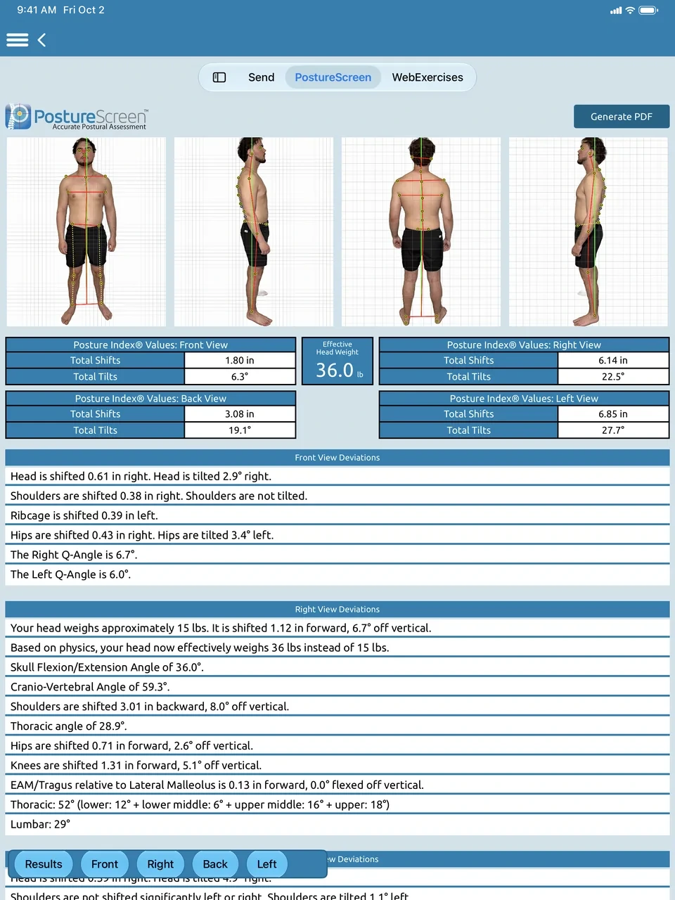 PostureScreen 4-view results on iPad: front, right, back and left photos above Posture Index values for every view and lists of deviations.
