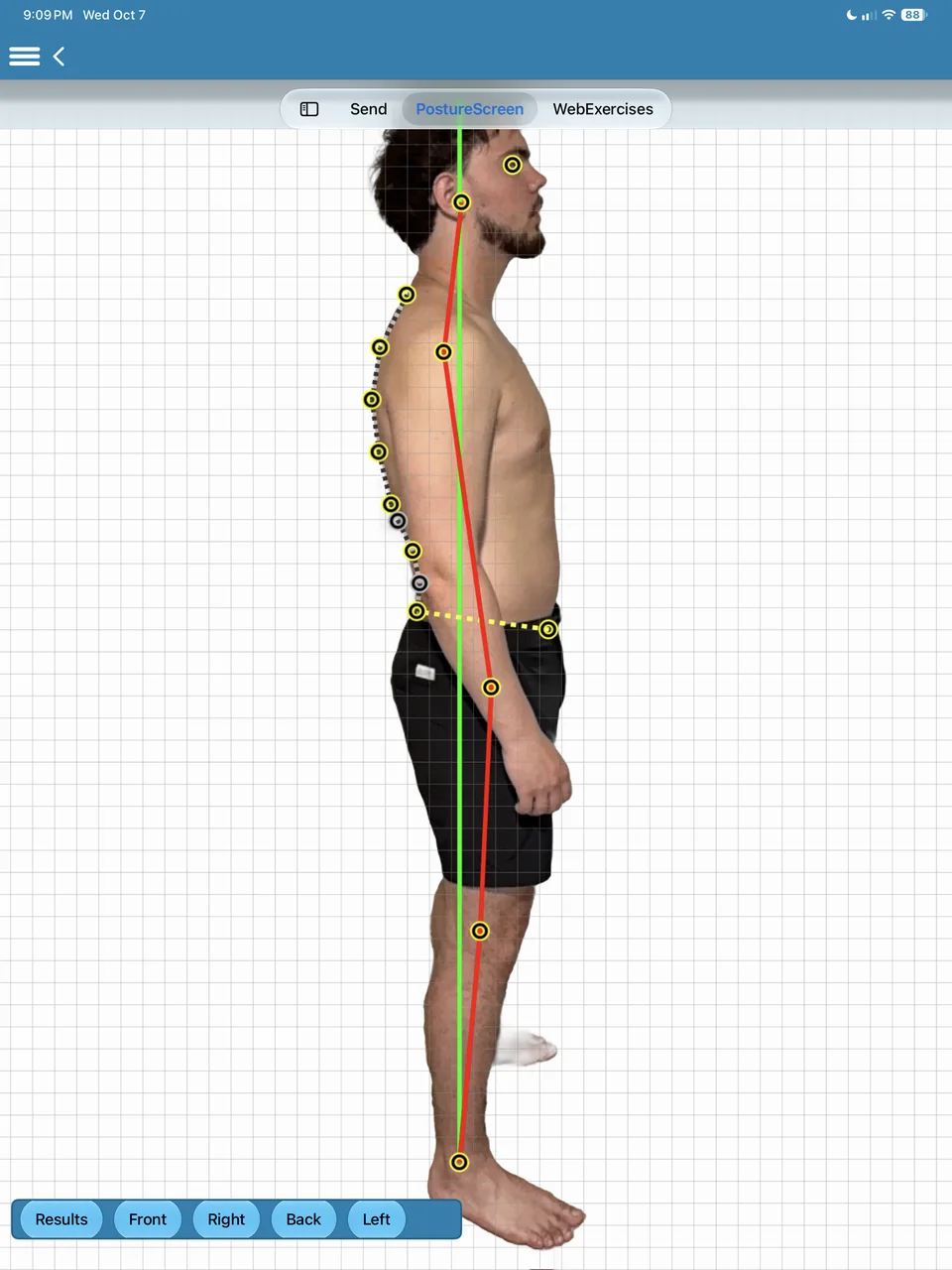 Right side view: landmarks from ear to ankle with the posture line and the plumb line.